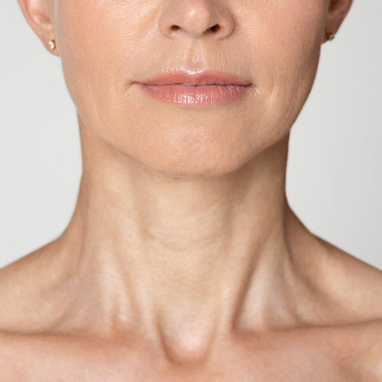 Neck Aging